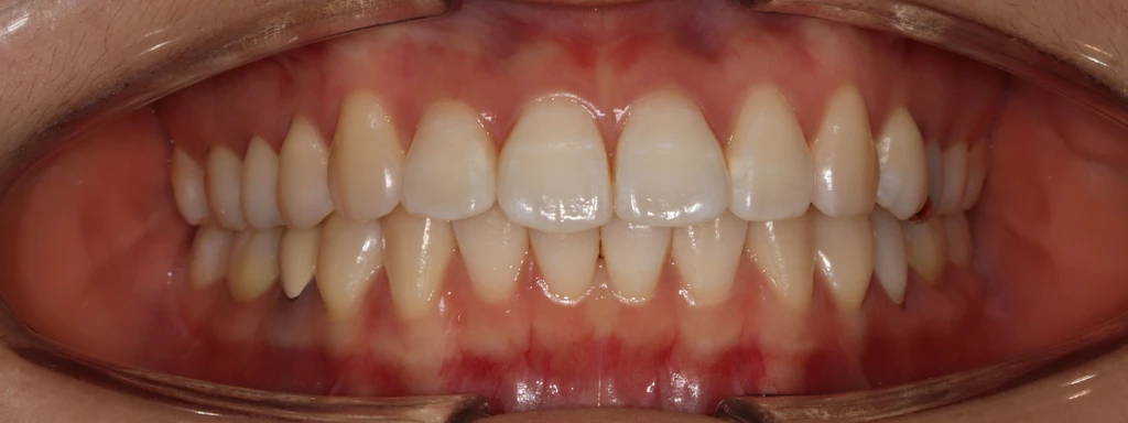 before_image