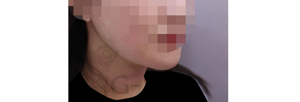 before_image