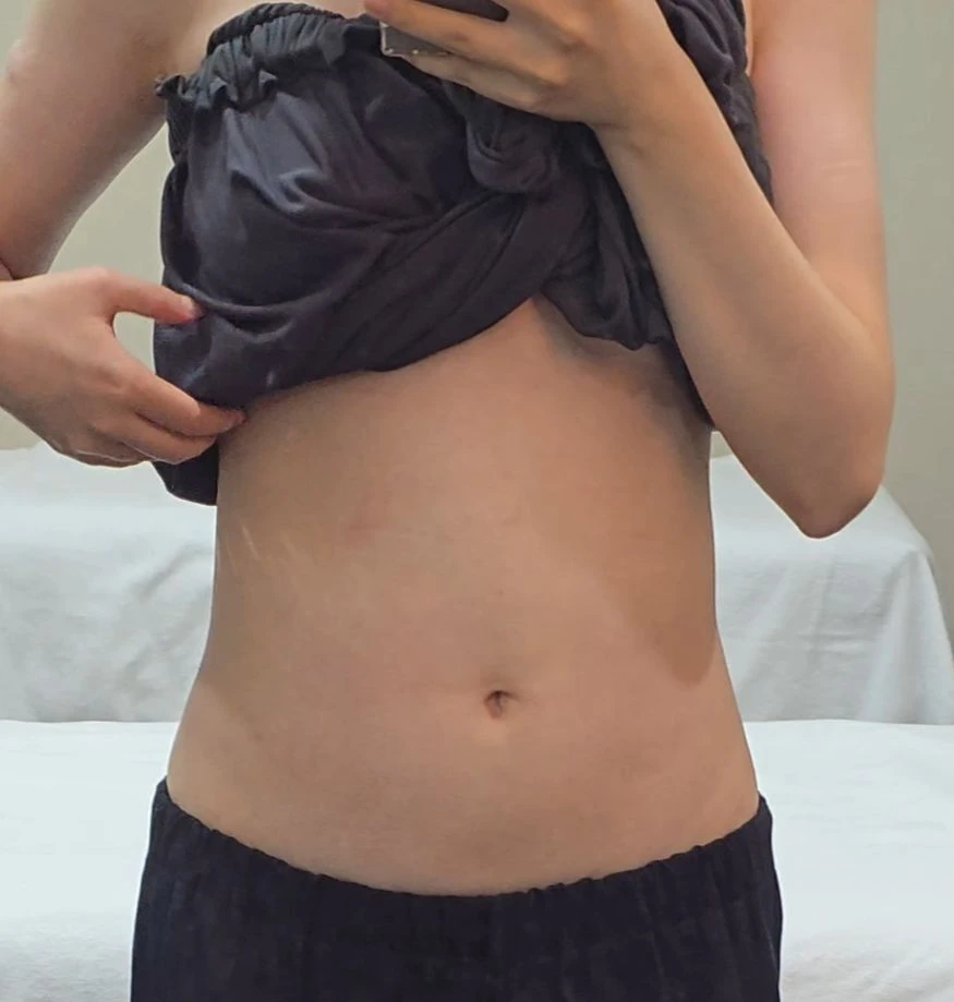 before_image