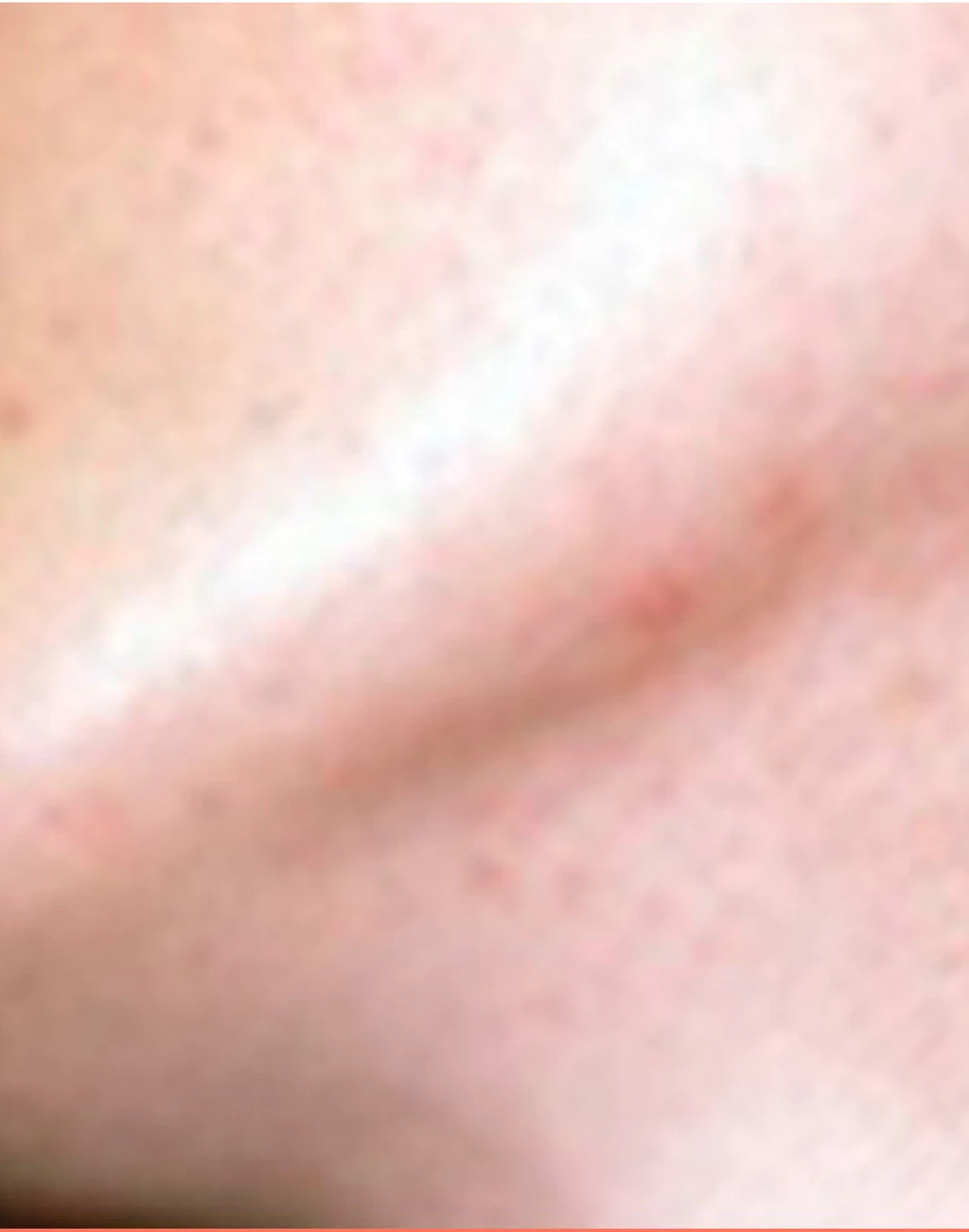 before_image