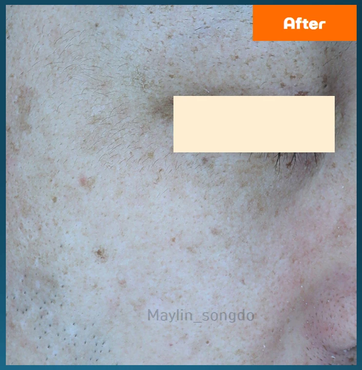 before_image