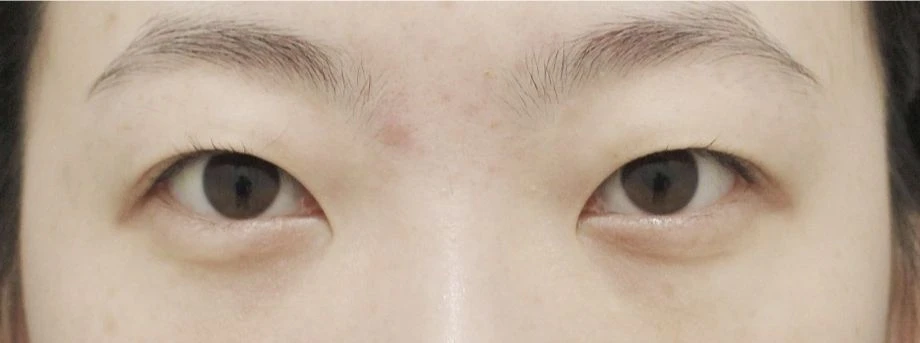 before_image