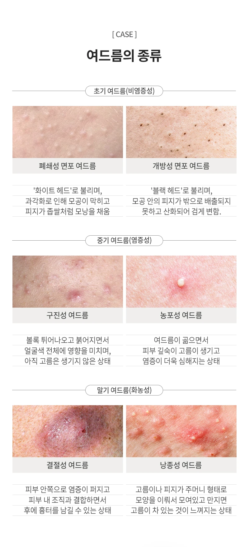 treatmentIntroduction