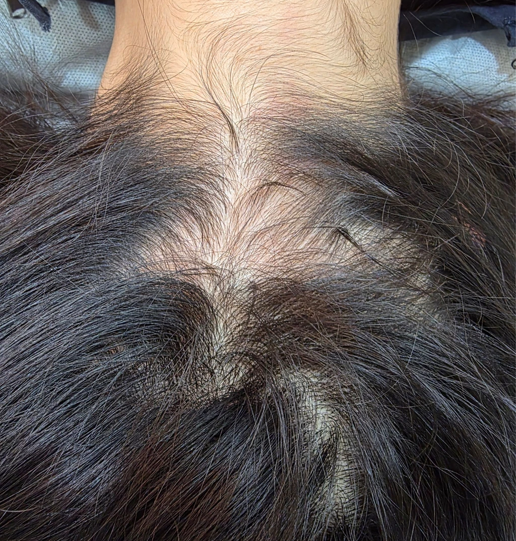 before_image