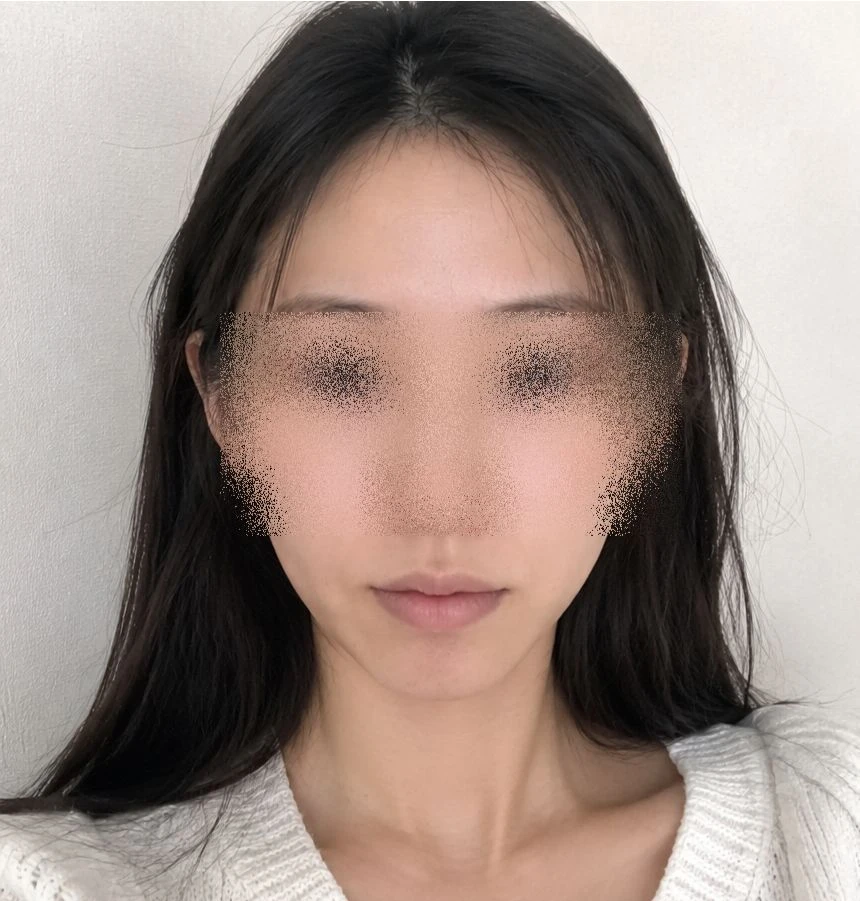 before_image