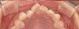 before_image
