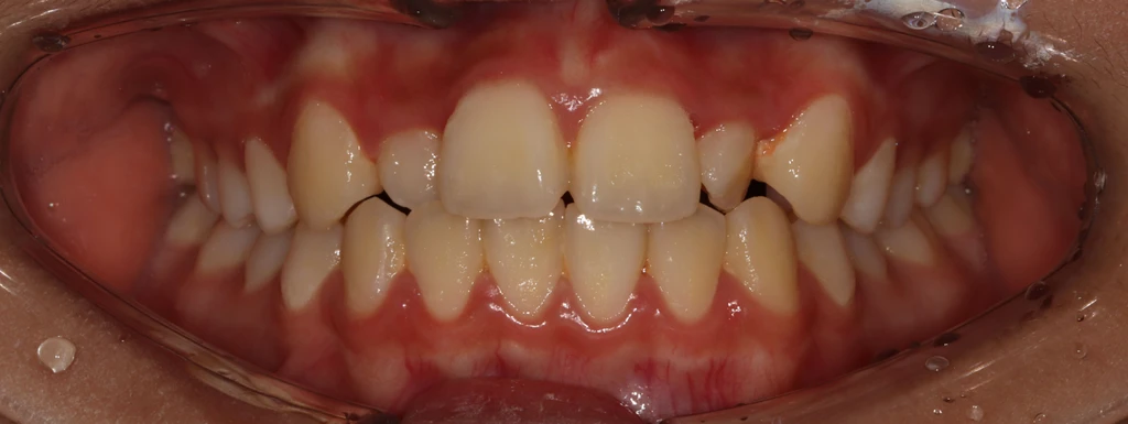 before_image