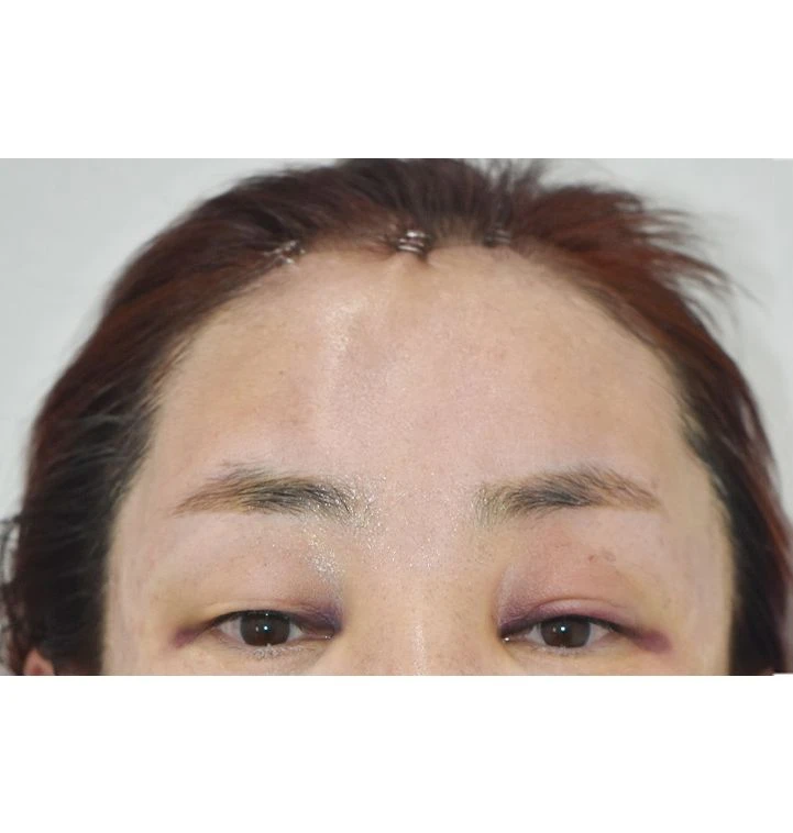 before_image
