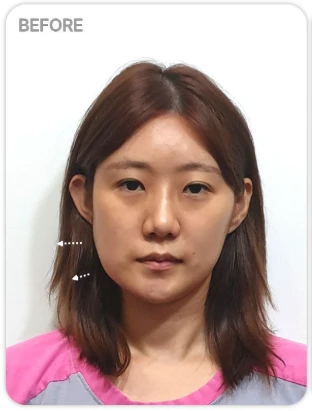 before_image