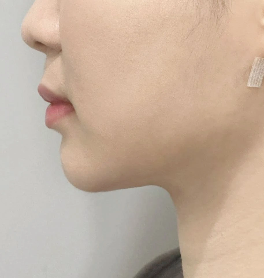 before_image