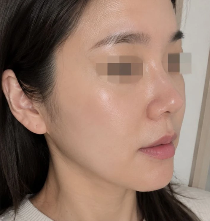 before_image