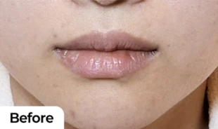 before_image