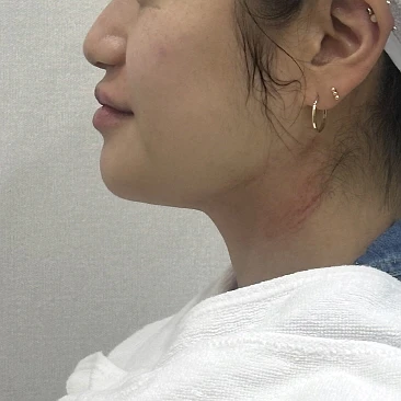 before_image