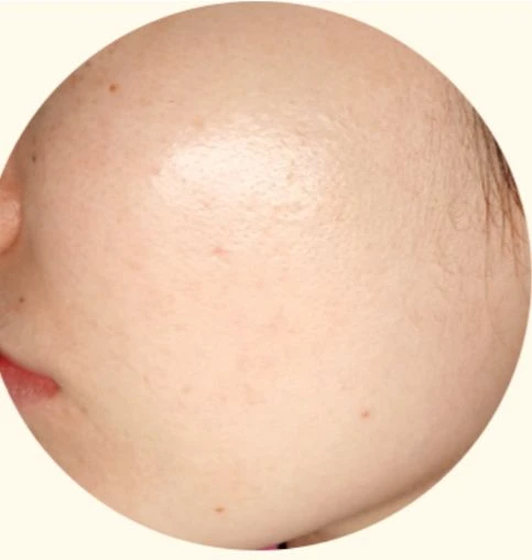 before_image