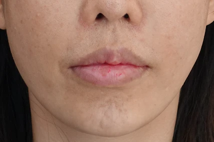 before_image