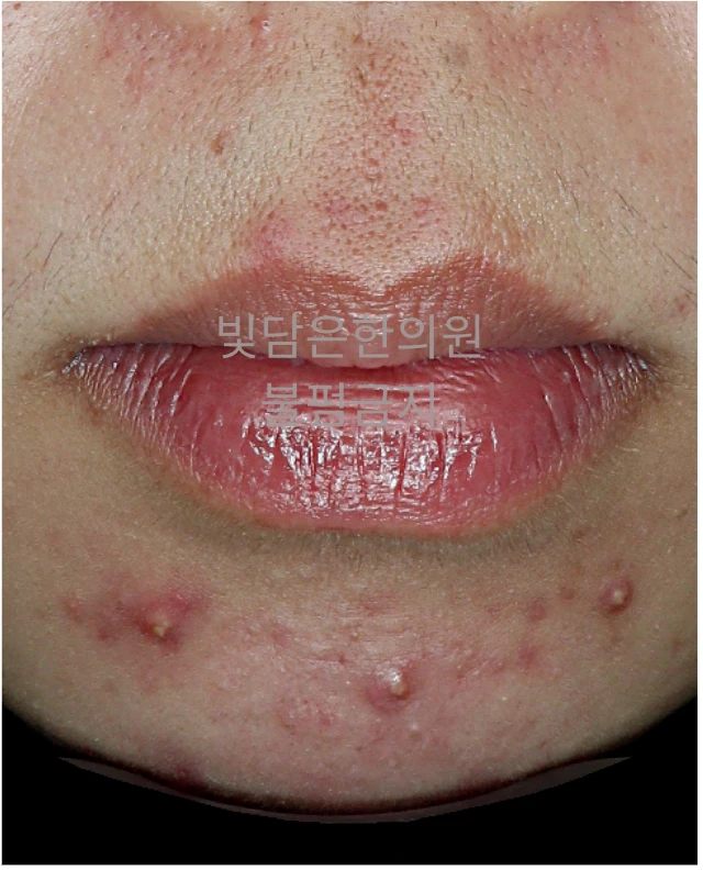before_image