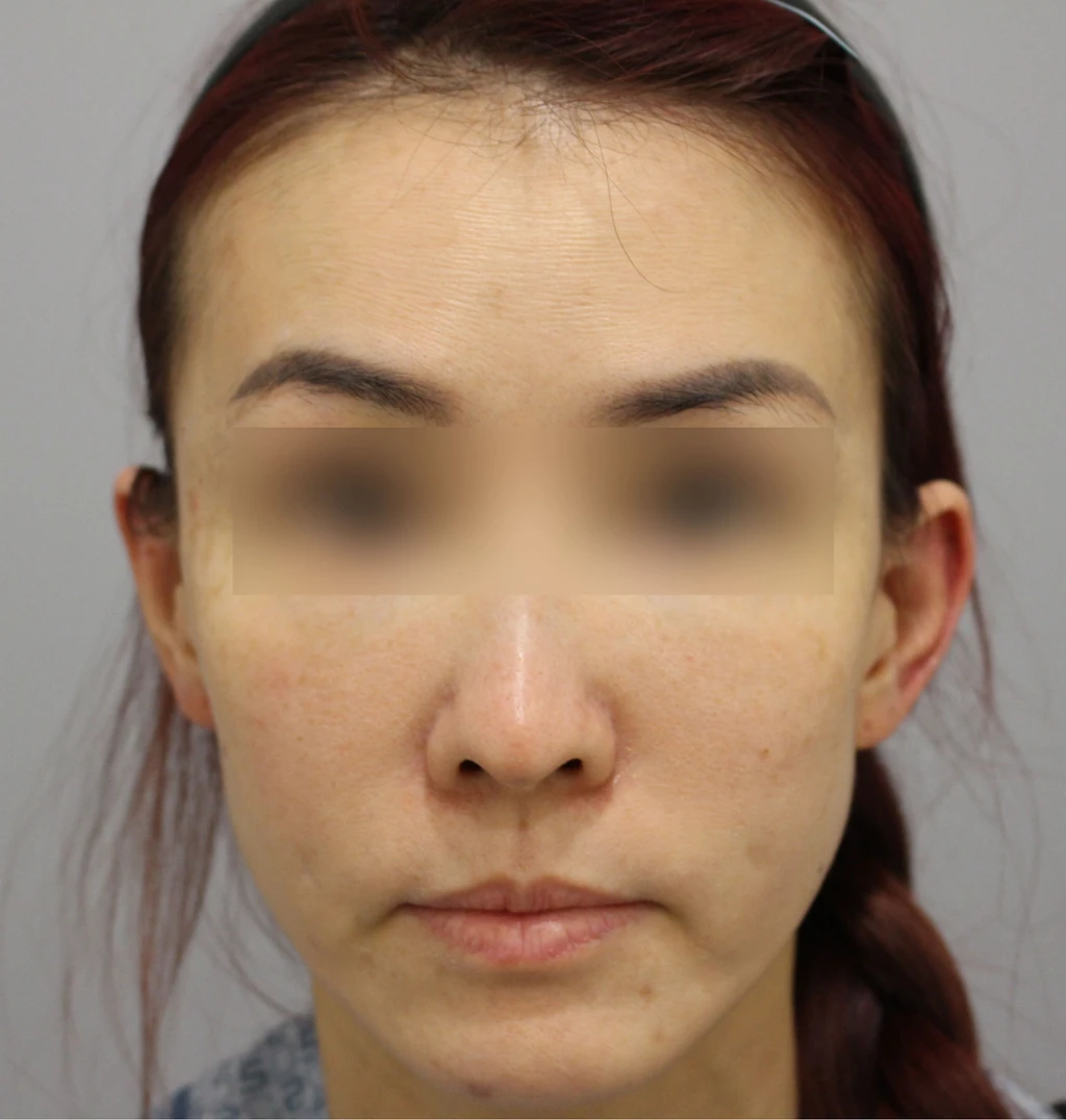 before_image