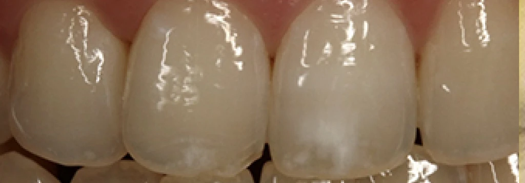 before_image