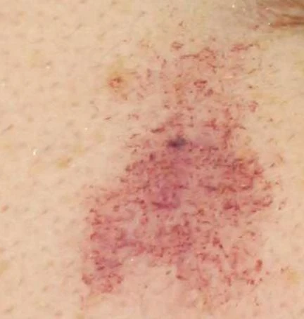 before_image