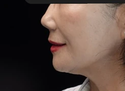 before_image