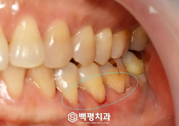 before_image