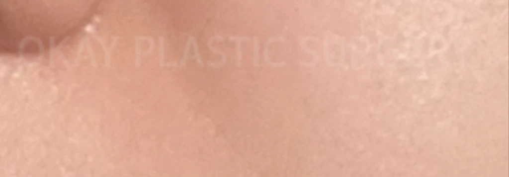 before_image