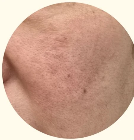before_image