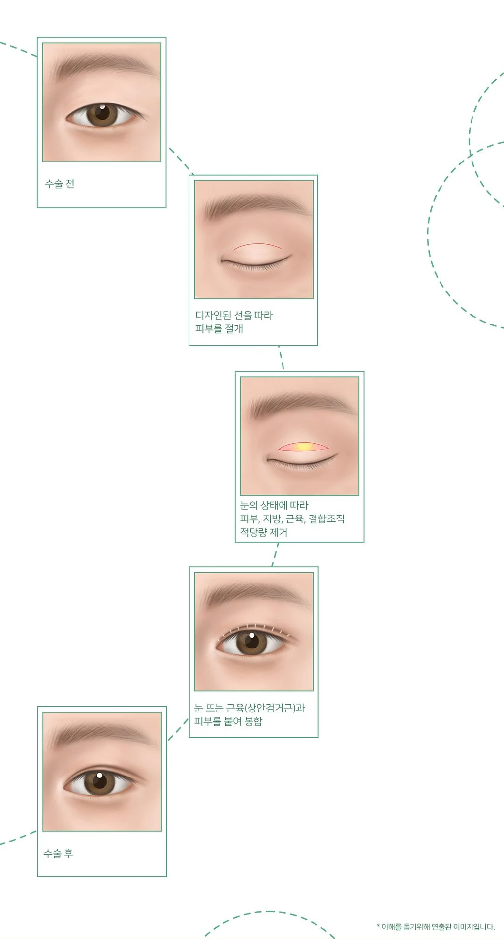 treatmentIntroduction