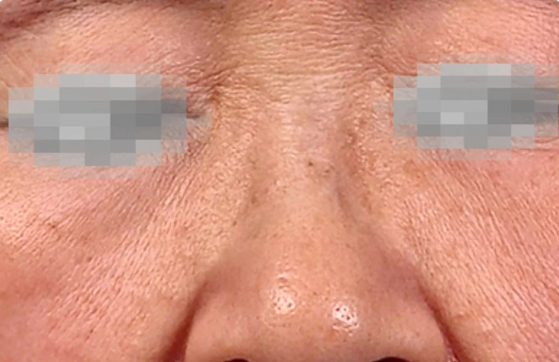 before_image
