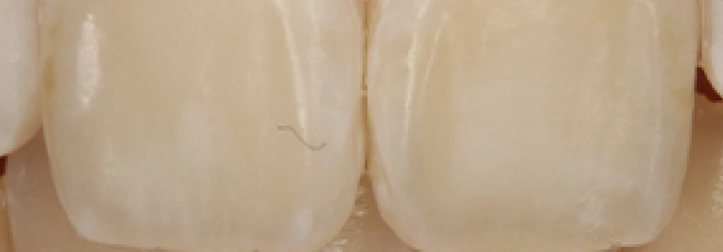 before_image