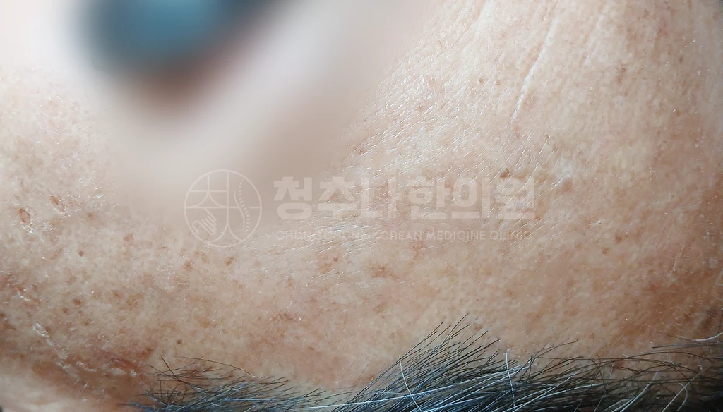before_image
