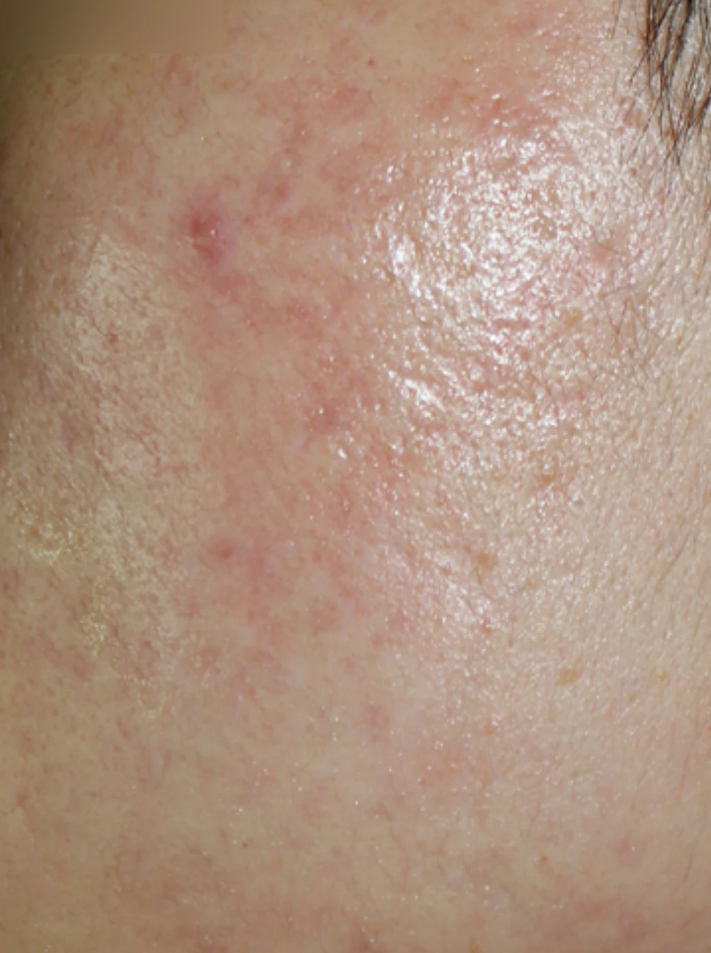 before_image