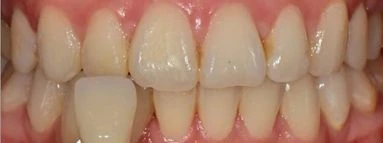 before_image