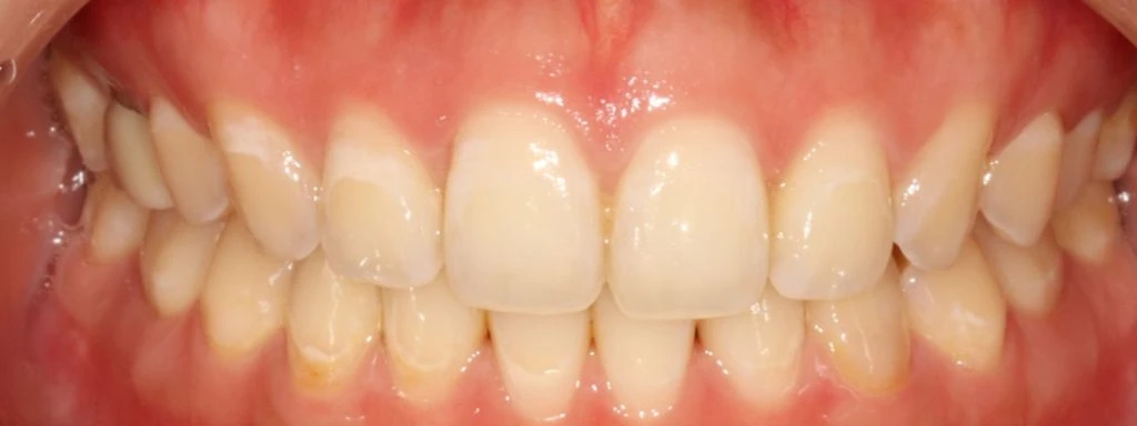 before_image