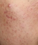 before_image
