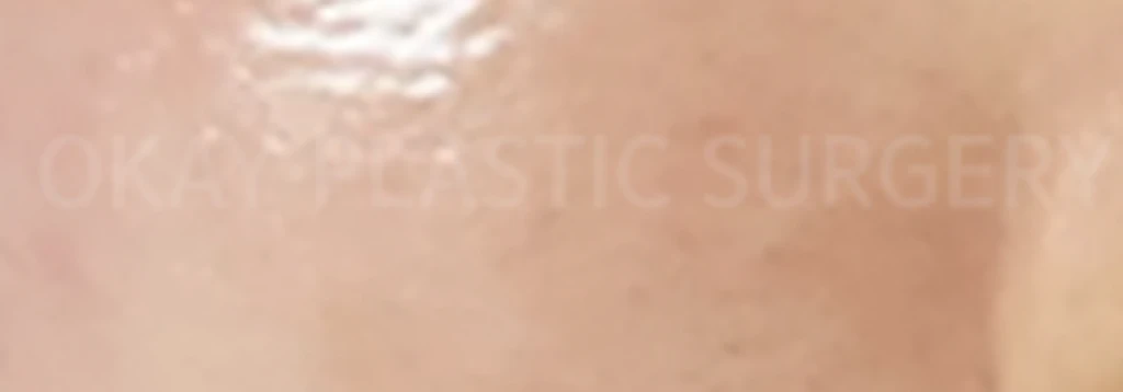 before_image