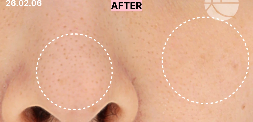 before_image