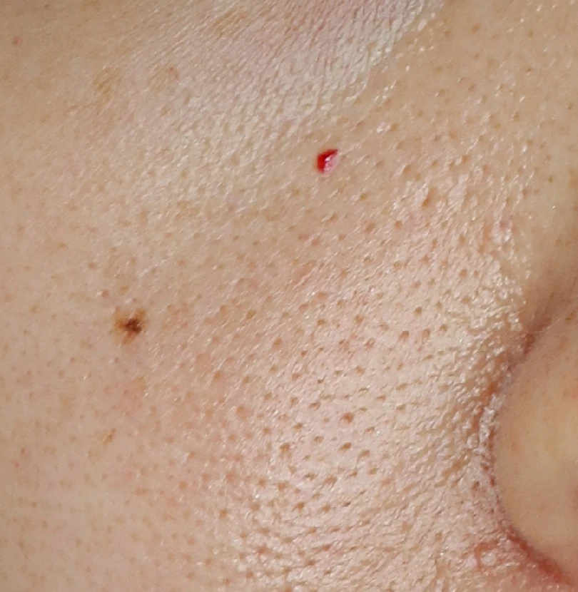 before_image