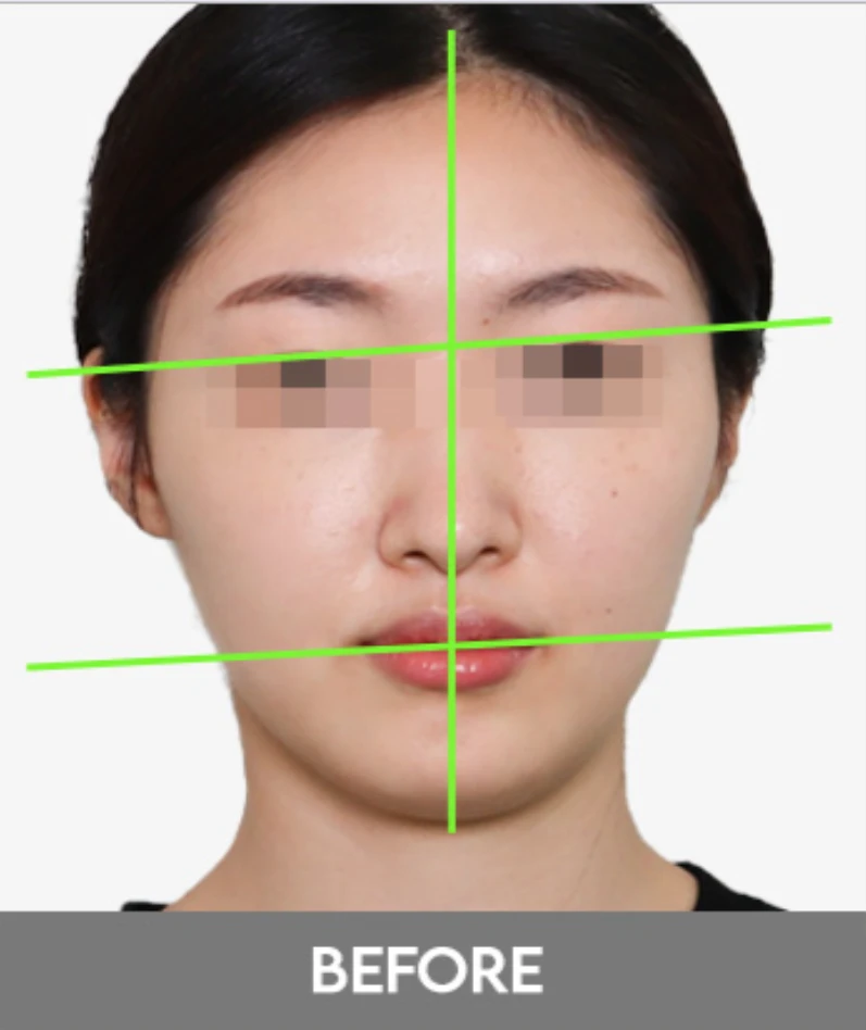 before_image