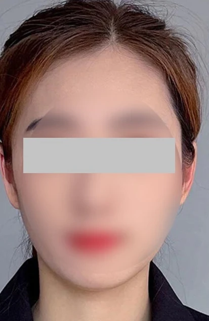 before_image