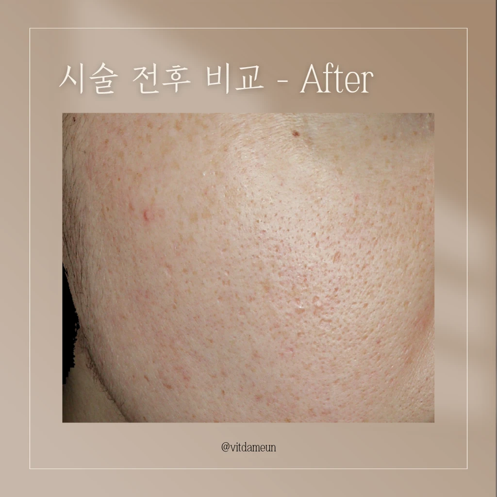 before_image