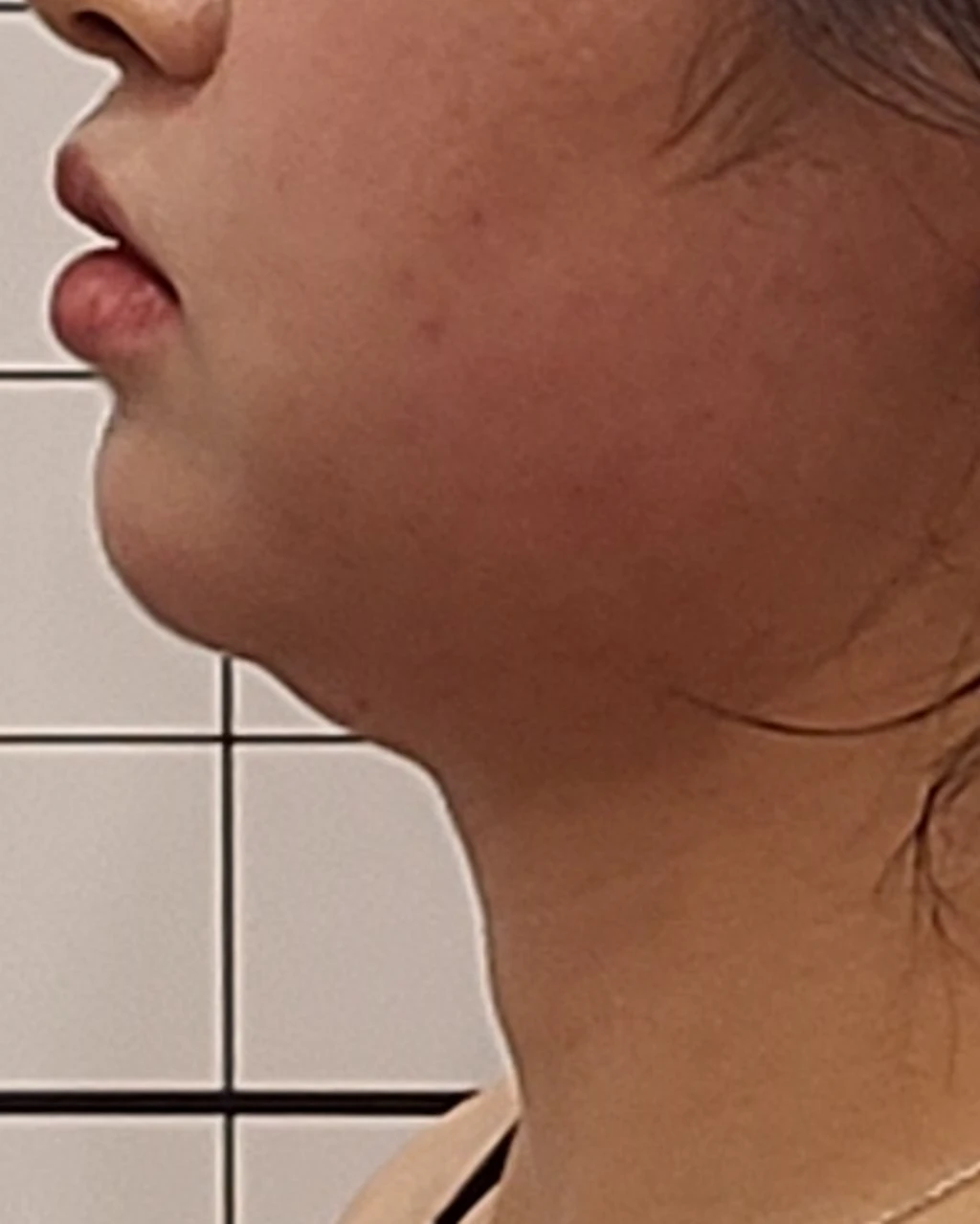 before_image