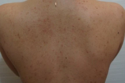before_image