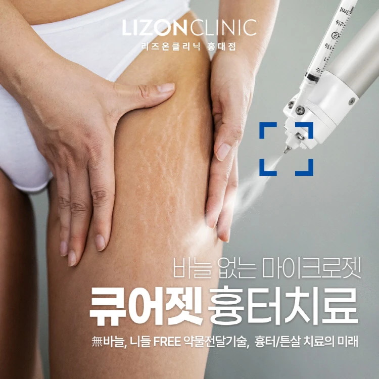 treatmentIntroduction