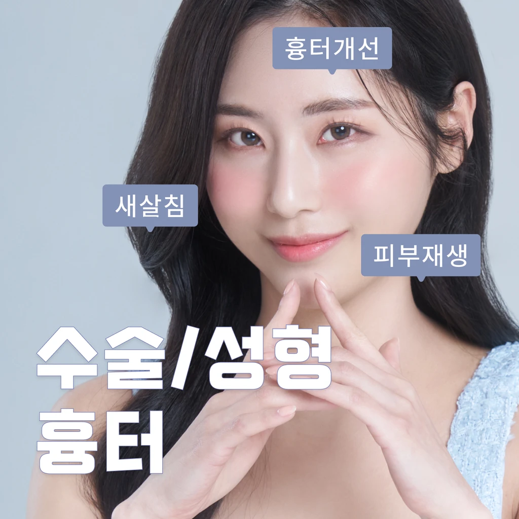 event thumbnail image