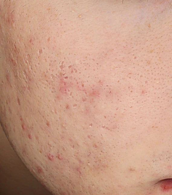 before_image