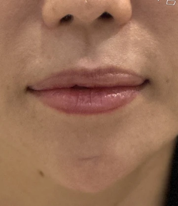 before_image