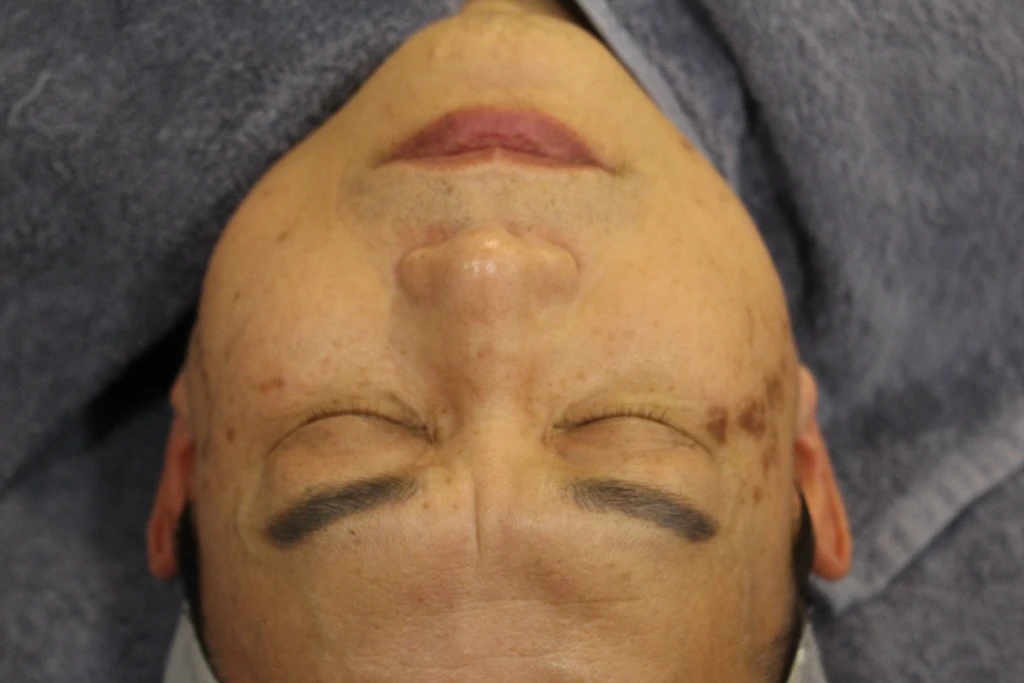 before_image