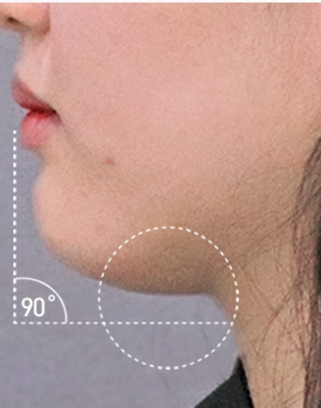 before_image