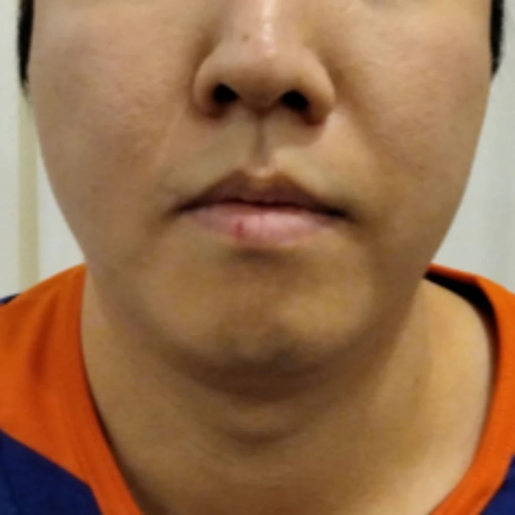 before_image